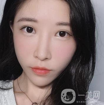 成都華美醫(yī)院做眉毛怎么樣?真實(shí)*果圖和價(jià)格一覽表展示