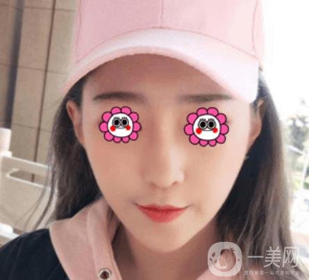 北京圣嘉榮整形價(jià)格表，內(nèi)附黃大勇整形醫(yī)生顴骨內(nèi)推案例*果圖展示