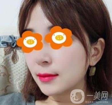 長沙貝美醫(yī)院做鼻子怎么樣?一覽價(jià)格表費(fèi)用詳情