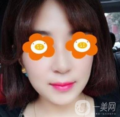 長沙貝美醫(yī)院做鼻子怎么樣?一覽價(jià)格表費(fèi)用詳情