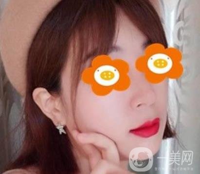 長沙貝美醫(yī)院做鼻子怎么樣?一覽價(jià)格表費(fèi)用詳情