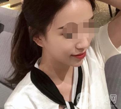 重慶附一院整形科價格表2020年公布，附祛痣整形日記