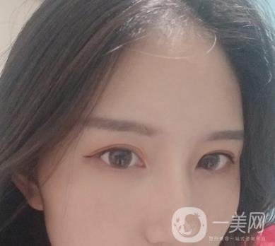 布仁醫(yī)生隆鼻