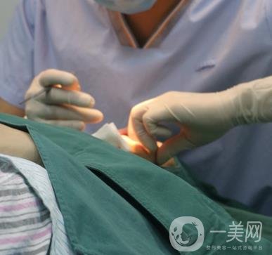 上海時光醫(yī)院何晉龍磨骨怎么樣？價格表及術后*果分享