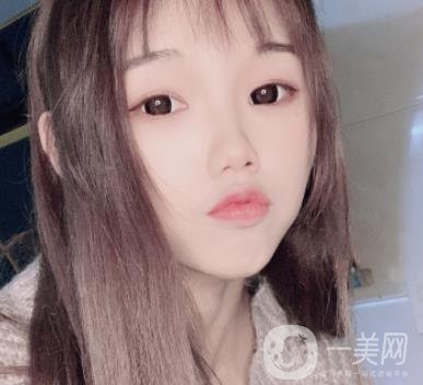 上海時光醫(yī)院何晉龍磨骨怎么樣？價格表及術后*果分享