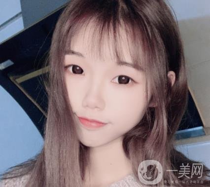 上海時光醫(yī)院何晉龍磨骨怎么樣？價格表及術后*果分享