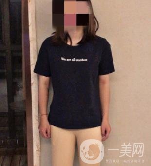 中南大學(xué)第一醫(yī)院整形美容科價(jià)格表*新發(fā)布,附全身吸脂*果分享