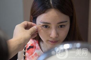 北京處整形外科價(jià)格(目)表2020一覽，附雙眼皮案例