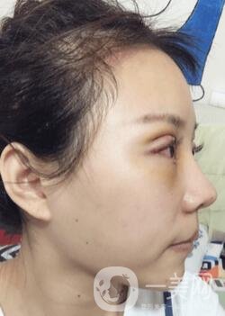 蘭大二院整形外科價(jià)格表2020，附雙眼皮整形日記