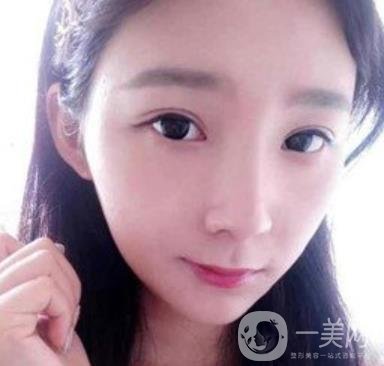 浙一醫(yī)院*誰打的好?附真人案例及整形價格表