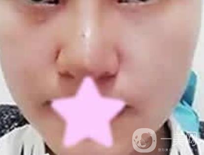 寶雞人民醫(yī)院*