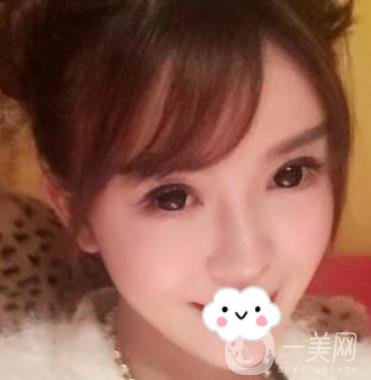 金華中心醫(yī)院自體脂肪填充