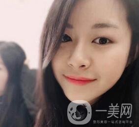 上海華美醫(yī)療美容醫(yī)院價格表，附雙眼皮修復(fù)案例