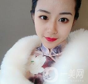 上海華美醫(yī)療美容醫(yī)院價格表，附雙眼皮修復(fù)案例