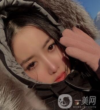 廣州曙光醫(yī)學美容醫(yī)院價格表及肋軟骨隆鼻案例分享