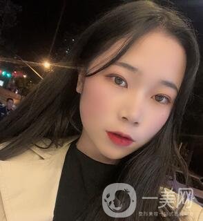 西安高一生醫(yī)療美容醫(yī)院價(jià)格表，附面部吸脂案例分享