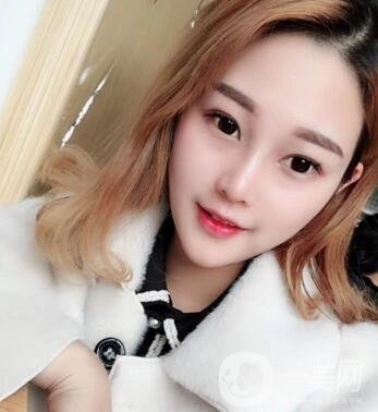 成都銅雀臺整形醫(yī)院隆鼻案例分享，附全新價格表