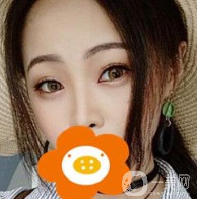 蚌埠美萊塢整形醫(yī)院玻尿酸隆鼻*果如何？價(jià)格表2020年收費(fèi)公布