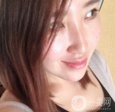 常州美貝爾整形美容醫(yī)院*注射多少錢？?jī)r(jià)格明細(xì)和*果圖展示