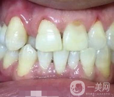 貴州口腔醫(yī)院正畸醫(yī)生信息介紹?內(nèi)含牙齒美容項目價格表及案例