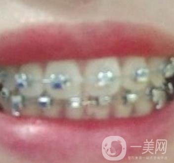 貴州口腔醫(yī)院正畸醫(yī)生信息介紹?內(nèi)含牙齒美容項目價格表及案例