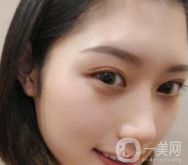 青醫(yī)附院王彥進(jìn)去痣怎么樣？?jī)r(jià)格表及*果展示