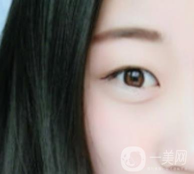 沈陽百嘉麗醫(yī)院價格表2020，附雙眼皮案例分享