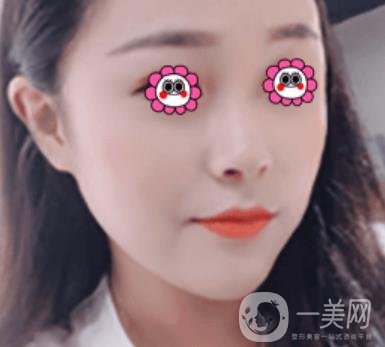 沈陽伊美爾整形醫(yī)院價格表，附祛斑*果展示