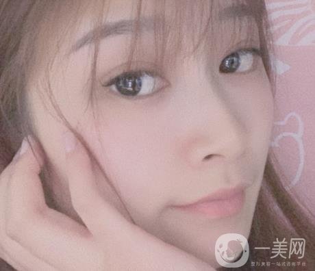 青島新陽(yáng)光婦產(chǎn)醫(yī)院縮陰手術(shù)恢復(fù)經(jīng)歷和價(jià)格價(jià)目表一覽