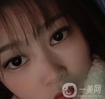 青島新陽(yáng)光婦產(chǎn)醫(yī)院縮陰手術(shù)恢復(fù)經(jīng)歷和價(jià)格價(jià)目表一覽