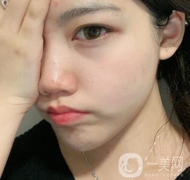 上海星和醫(yī)美整形醫(yī)院*祛斑*果圖和價(jià)格價(jià)目表2020年