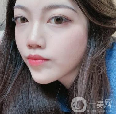 上海星和醫(yī)美整形醫(yī)院*祛斑*果圖和價(jià)格價(jià)目表2020年