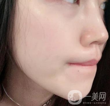 上海星和醫(yī)美整形醫(yī)院*祛斑*果圖和價(jià)格價(jià)目表2020年