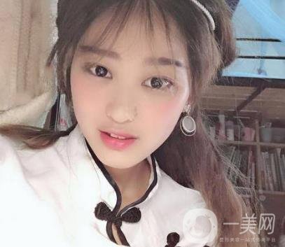 西安華旗唯美整形醫(yī)院做*多少錢(qián)？?jī)r(jià)格表收費(fèi)明細(xì)和案例分享