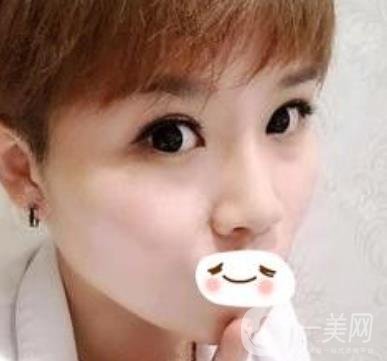 四川省人民醫(yī)院整形科駝峰鼻矯正多少錢？價(jià)格表2020更新