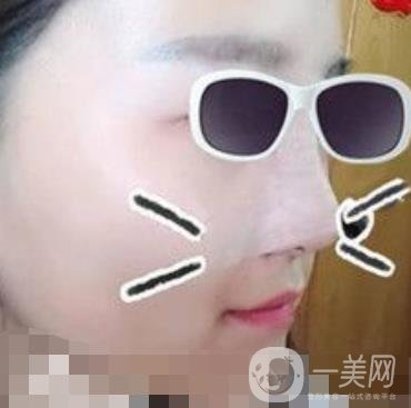 北京亞楠容悅醫(yī)療美容**果靠譜嗎?2020年價(jià)格明細(xì)一覽表