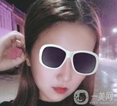 北京亞楠容悅醫(yī)療美容**果靠譜嗎?2020年價(jià)格明細(xì)一覽表