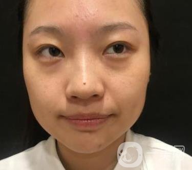 北京知音醫(yī)療美容熱瑪吉*果怎么樣？貴嗎？收費價格表2020公布