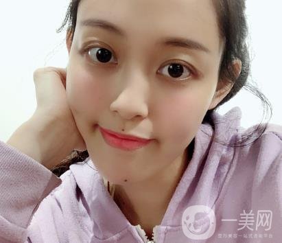 成都美容整形醫(yī)院做脂肪填充全臉*果靠譜嗎?近期價格表和案例參考