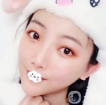 無(wú)錫二院雙眼皮做得好的醫(yī)生?附2020整形價(jià)格表及案例