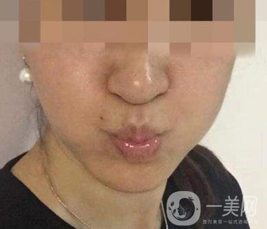 寧波第一醫(yī)院整形美容科價格表（價格）新版發(fā)布,及*案例*果