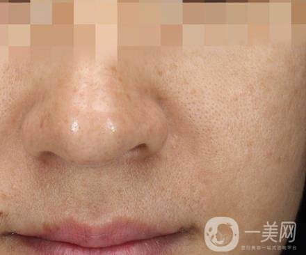 寧波第一醫(yī)院整形美容科價格表（價格）新版發(fā)布,及*案例*果