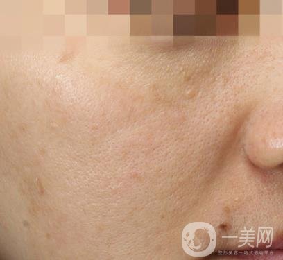 寧波第一醫(yī)院整形美容科價格表（價格）新版發(fā)布,及*案例*果