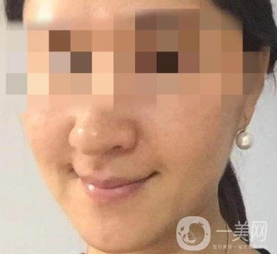 寧波第一醫(yī)院整形美容科價格表（價格）新版發(fā)布,及*案例*果