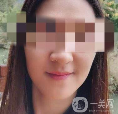 寧波第一醫(yī)院整形美容科價格表（價格）新版發(fā)布,及*案例*果