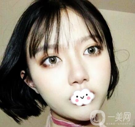 贛南醫(yī)學(xué)院第一附屬醫(yī)院整形美容科價(jià)格表2020+雙眼皮案例一覽