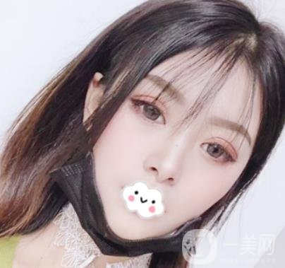 徐州亞韓整形醫(yī)院價格表2020新版+雙眼皮整形日記一覽