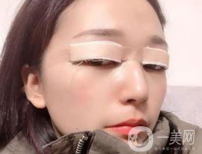 恩施州中心醫(yī)院美容整形科怎么樣？價格表和雙眼皮整形經(jīng)歷分享