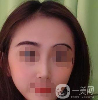 南昌二附院整形美容科價(jià)格表及祛痣日志公開，速覽