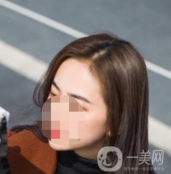 南昌二附院整形美容科價(jià)格表及祛痣日志公開，速覽